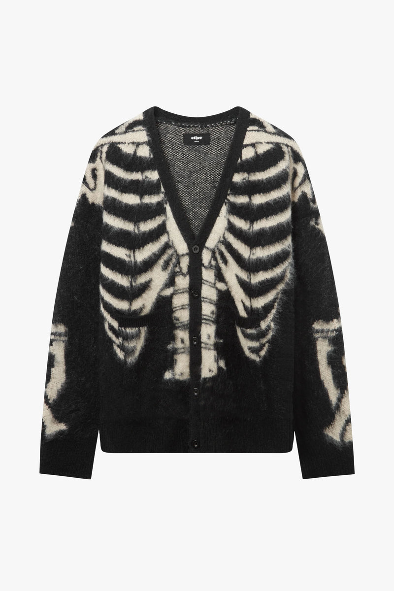 SKELETON OVERSIZED CARDIGAN - BLACK & BONE - WOMENS