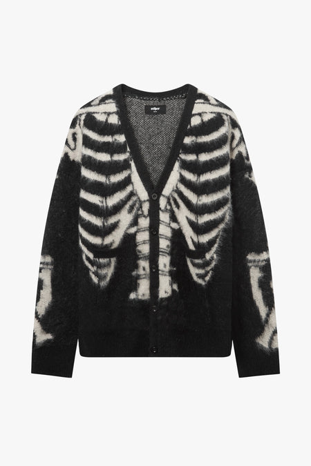 SKELETON OVERSIZED CARDIGAN - BLACK & BONE